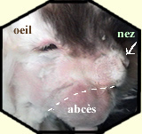 Abces mandibulaire